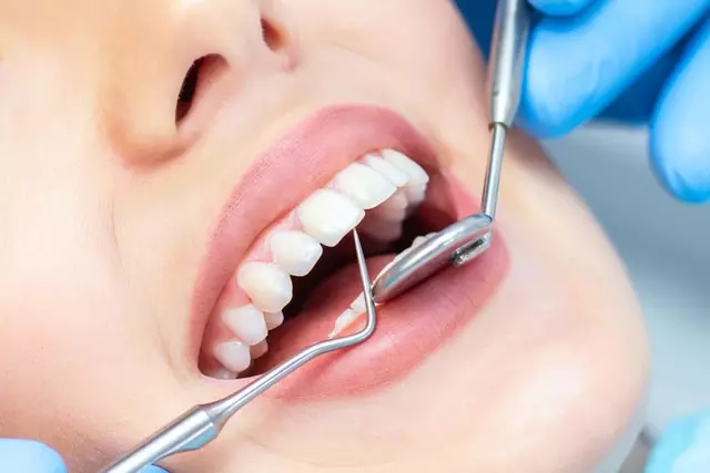 Clopidogrel y Procedimientos Dentales: Lo que Necesita Saber